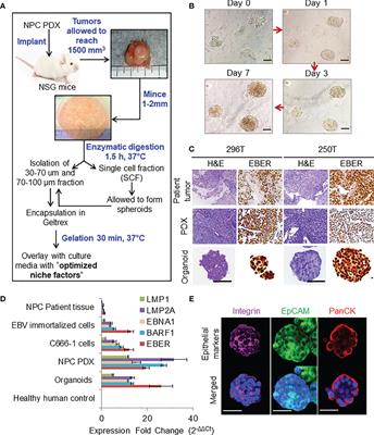Patient-Derived Nasopharyngeal Cancer Organoids for Disease Modeling and Radiation Dose Optimization